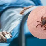 Sonora suma 18 muertes por rickettsia y 38 casos confirmados
