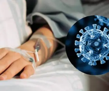 Reportan muerte de paciente con metapneumovirus en Cholula, Puebla