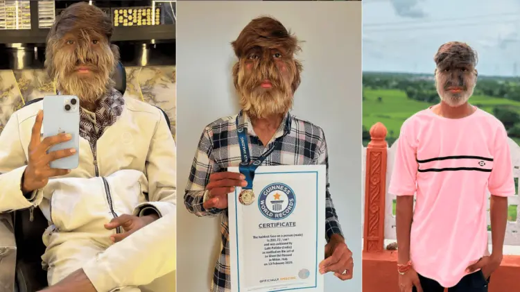 Lalit Patidar padece de hipertricosis, y muestra su vida en redes sociales. (Foto: @lalitpatidar520)