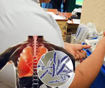 Ante casos de tos ferina, vacuna hexavalente previene brotes en Sonora