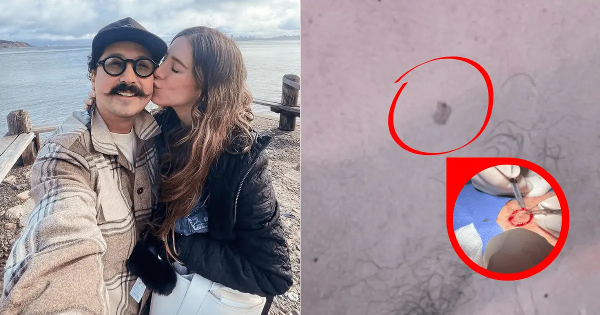 Mau Nieto tuvo cáncer de piel sin saberlo: su esposa lo detectó a tiempo