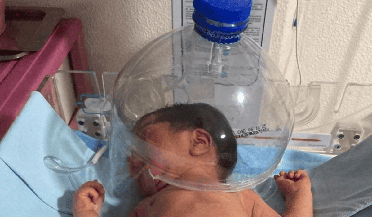 Médicos usan botella para salvar la vida de recién nacido en Tabasco
