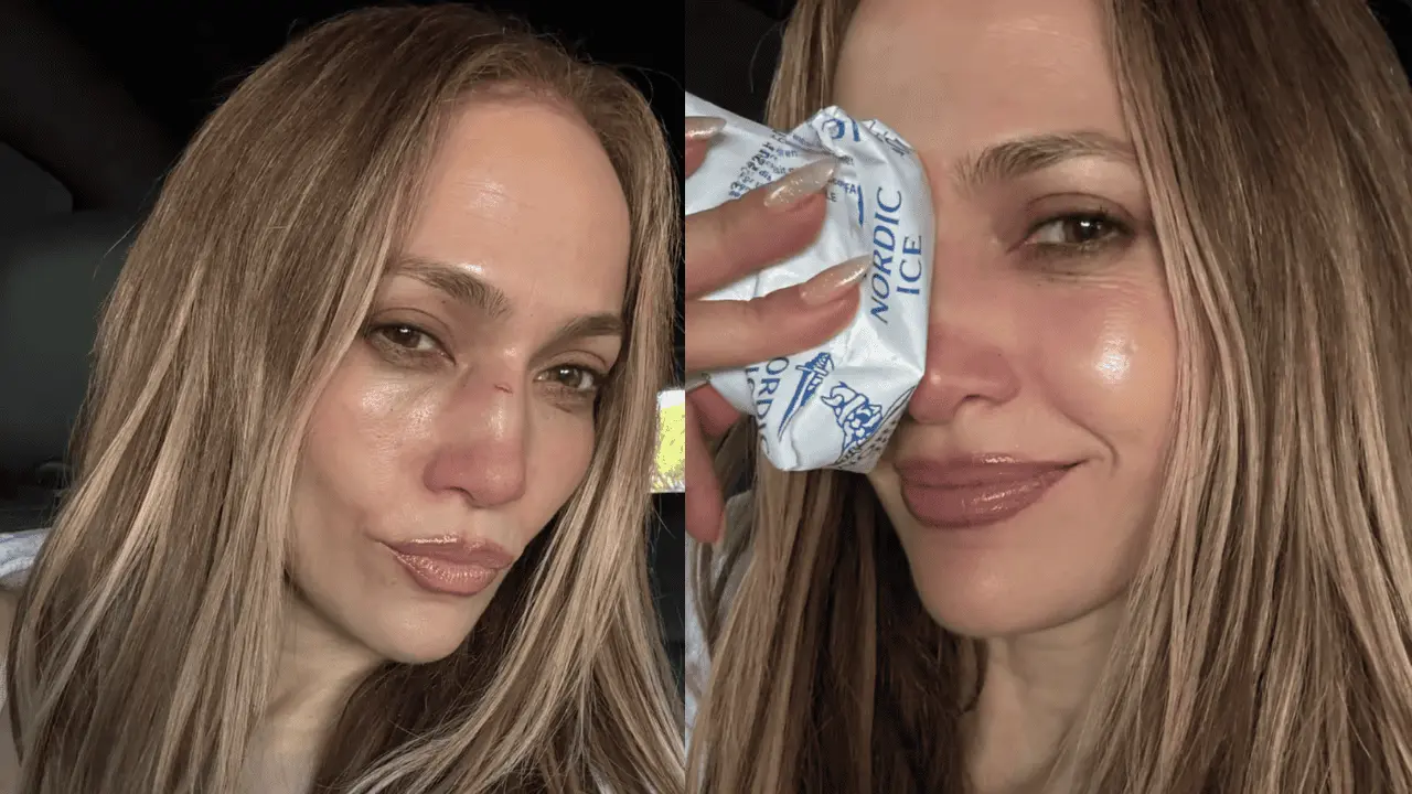 Jennifer Lopez sufre lesión durante ensayo de los American Music Awards 2025
