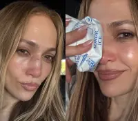 Jennifer Lopez sufre lesión durante ensayo de los American Music Awards 2025