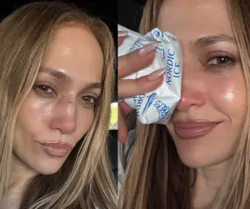 Jennifer Lopez sufre lesión durante ensayo de los American Music Awards 2025