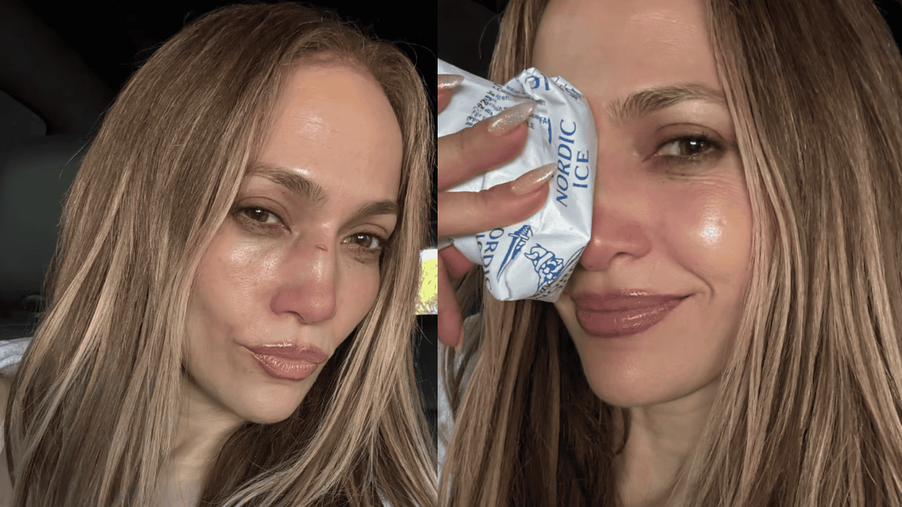 Jennifer Lopez sufre lesión durante ensayo de los American Music Awards 2025