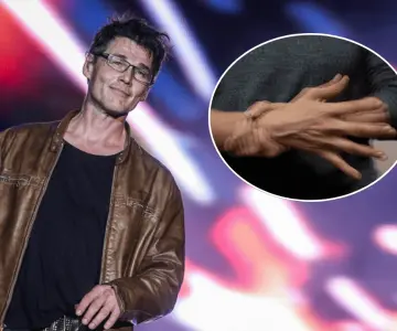 Morten Harket, vocalista de A-ha, revela que padece Parkinson