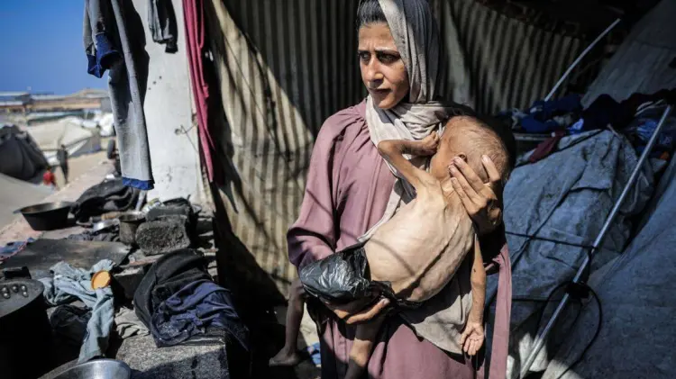 83 menores de edad han muerto por desnutrición en Gaza