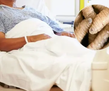 Cuatro personas son hospitalizadas por gusano barrenador
