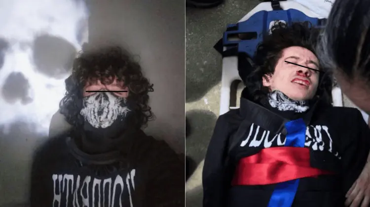 El homicida de 19 años sufrió graves lesiones al huir de la escena del crimen. (Foto: Especial/EXP)