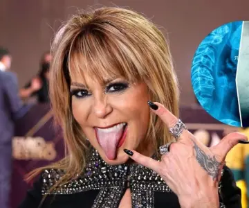 Alejandra Guzmán festeja 37 años de carrera tras cirugía