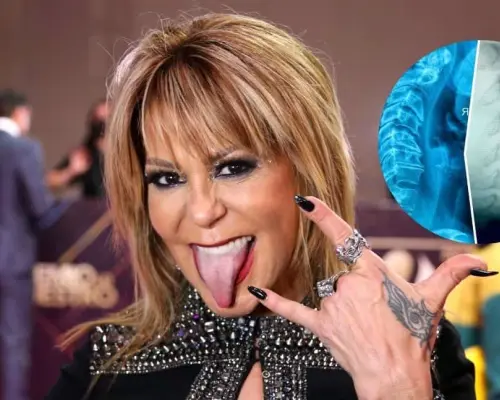 Alejandra Guzmán festeja 37 años de carrera tras cirugía