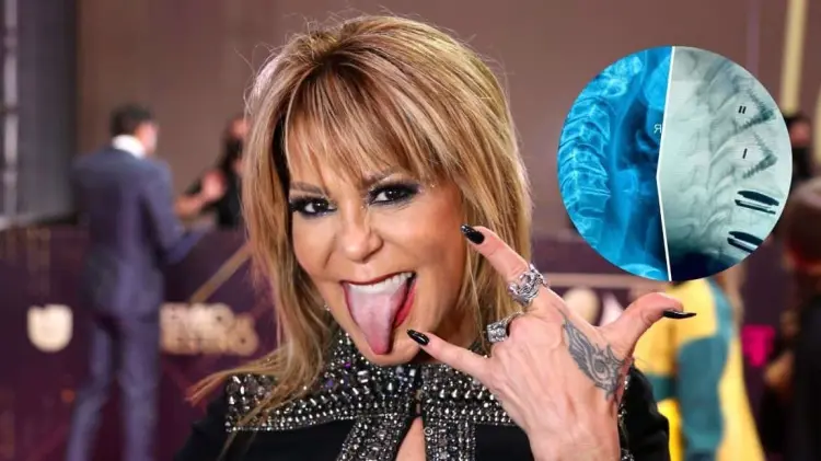 La cantante compartió en sus redes sociales la radiografía de su columna. (ESPECIAL/EXPRESO)