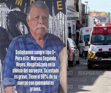 Mejor se hubiera muerto: Esposa de trabajador herido en incendio de Waldos