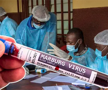 Confirman tres muertes por virus de Marburgo en Etiopía y activan medidas