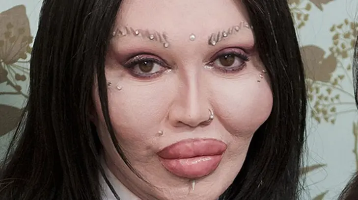Muere el cantante Pete Burns, exvocalista del grupo Dead or Alive