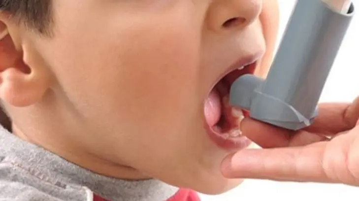 Sobrepeso y obesidad afectan control del asma, advierte neumólogo