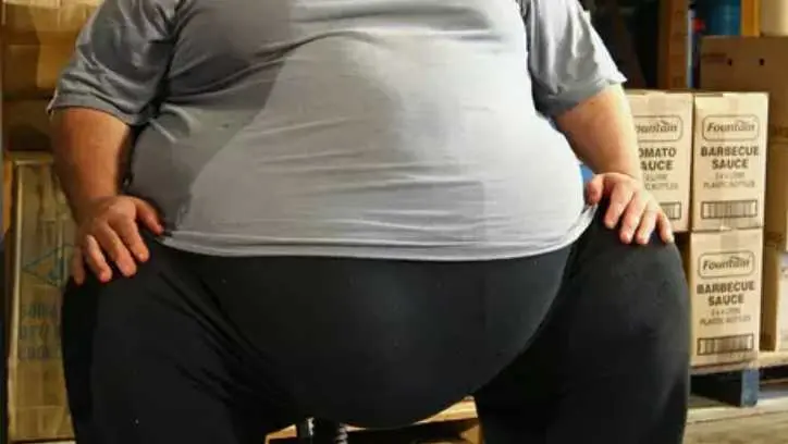 Cirujano tapatío es famoso internacionalmente por ayudar a obesos extremos