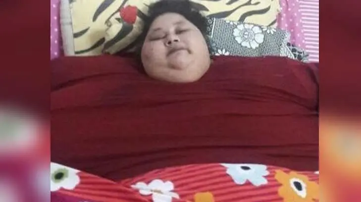Mujer más pesada del mundo pierde 100 kilos con cirugía