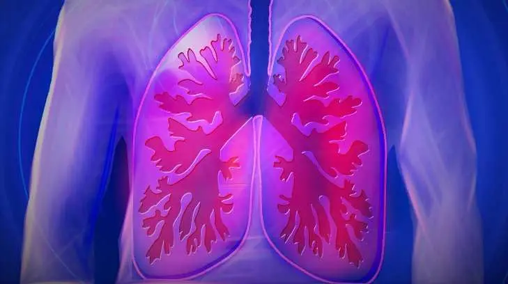 Así se ve el daño del Covid-19 en los pulmones