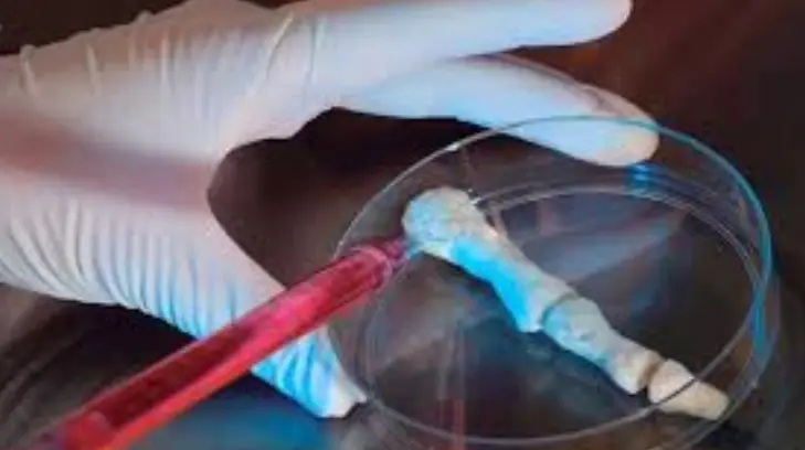 Científicos desarrollan tecnología para fabricar implantes de huesos artificiales