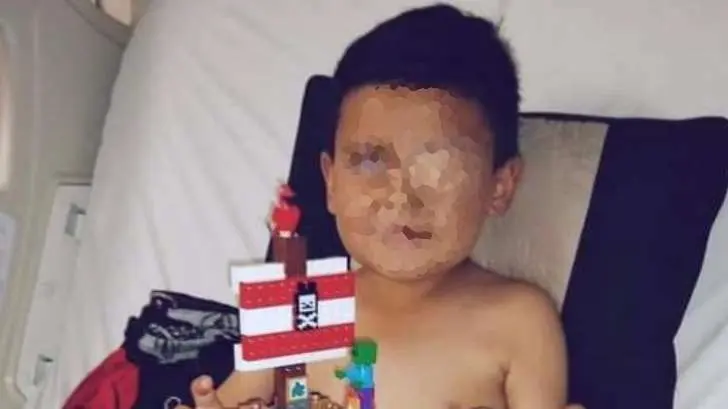 Niño con tumor cerebral requiere un fuerte apoyo de la comunidad