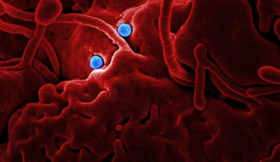 Confirman caso de coronavirus en Arizona
