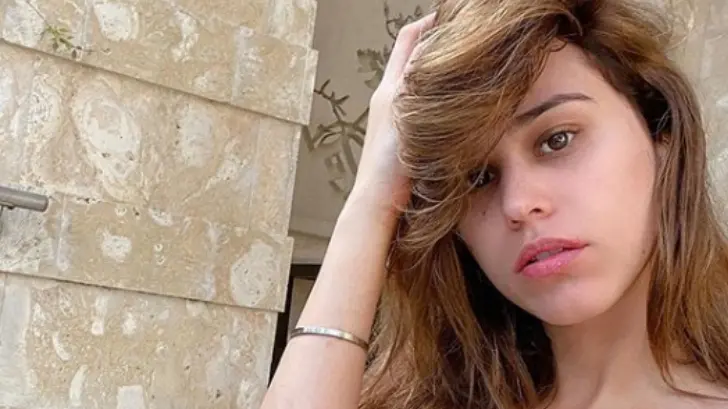 Yanet García muestra orgullosa las estrías en sus glúteos