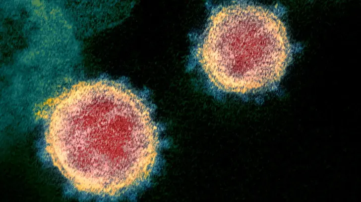 Infectados en el mundo por pandemia supera barrera de los 500 mil
