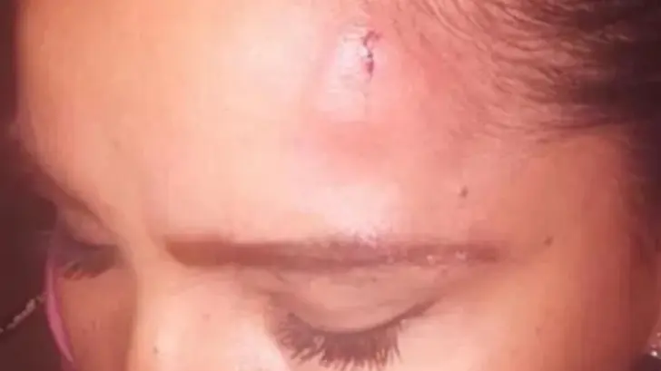 Hombre golpea con piedra a una mujer para robarle su celular