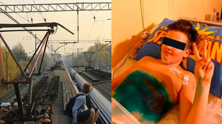 Niño pierde las piernas por hacer challenge de internet
