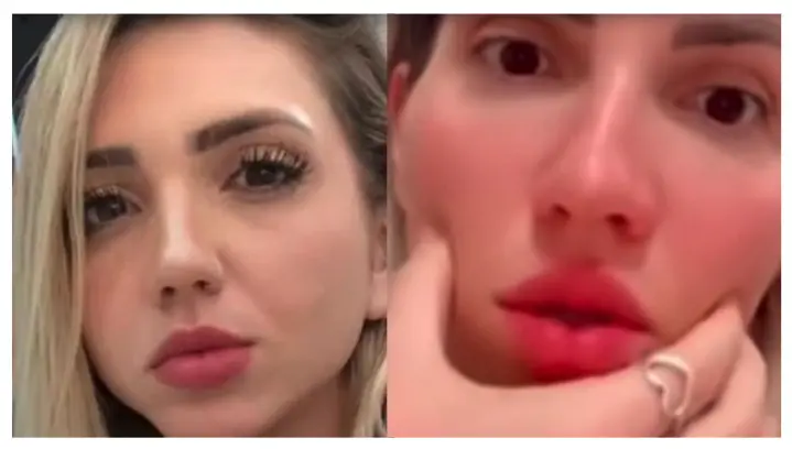 Tiktoker se arrepiente de hacerse bichectomía: Mi cara se cayó