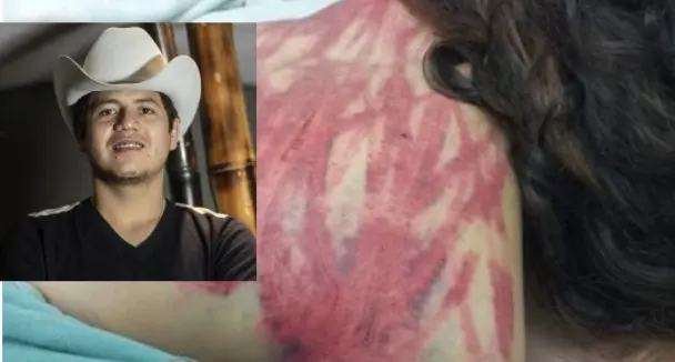 Está en problemas: ratifican la denuncia contra Remmy Valenzuela por violencia