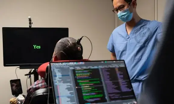 EU da permisos para probar los implantes cerebro-computadora en su territorio